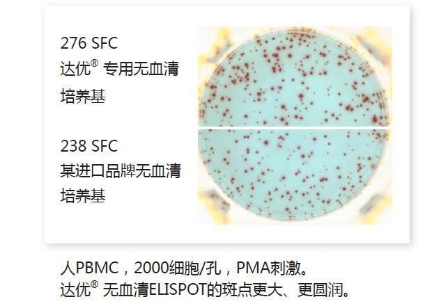 人淋巴细胞无血清培养基-斑点2.jpg